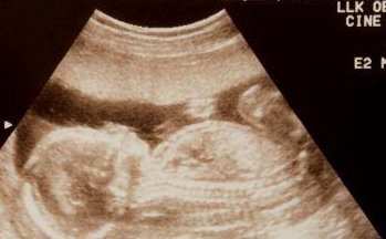 2026年想去宣威市做试管婴儿需要准备哪些事？详细收费明细一览